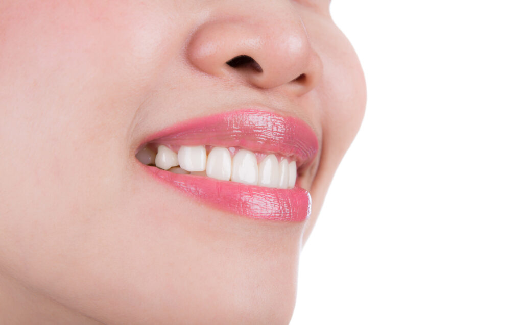 The Meaning of Cracking Teeth in Dreams