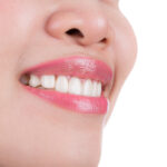 The Meaning of Cracking Teeth in Dreams